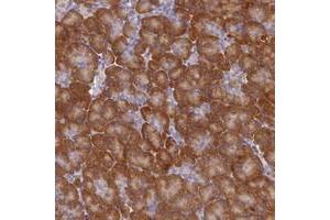 Immunohistochemical staining of human pancreas with ST7L polyclonal antibody  shows moderate cytoplasmic positivity in exocrine pancreas. (ST7L 抗体)