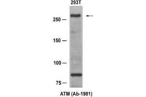 Image no. 1 for anti-Ataxia Telangiectasia Mutated (ATM) (Ser1981) antibody (ABIN319314) (ATM 抗体  (Ser1981))