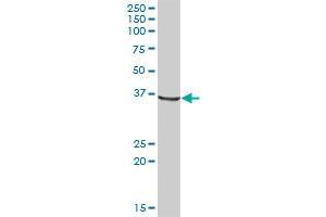AKR1A1 MaxPab polyclonal antibody.