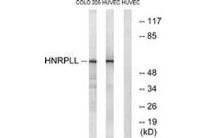 Western blot analysis of extracts from HuvEc/COLO cells, using HNRPLL Antibody.