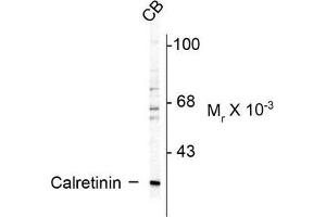 Image no. 1 for anti-Calbindin 2 (CALB2) antibody (ABIN372593) (Calretinin 抗体)