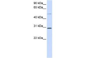WB Suggested Anti-PLA1A Antibody Titration:  0. (PLA1A 抗体  (Middle Region))