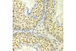 Immunohistochemistry of paraffin-embedded mouse testis using MAPK3 antibody at dilution of 1:100 (x400 lens). (ERK1 抗体)