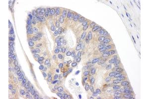 Immunohistochemistry (IHC) image for anti-BH3 Interacting Domain Death Agonist (BID) (AA 60-120) antibody (ABIN7448435)