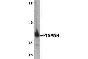 Western blot analysis of GAPDH in HeLa cell lysate with GAPDH antibody at 1 µg/mL. (GAPDH 抗体  (C-Term))
