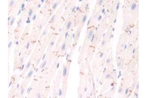 Detection of PIM1 in Mouse Cardiac Muscle Tissue using Polyclonal Antibody to Pim-1 Oncogene (PIM1) (PIM1 抗体  (AA 122-261))