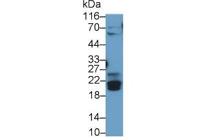 Detection of BNIP3 in Rat Skeletal muscle lysate using Polyclonal Antibody to Bcl2/Adenovirus E1B 19 kDa Interacting Protein 3 (BNIP3) (BNIP3 抗体  (AA 3-134))