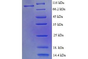 Replication Protein A1, 70kDa (RPA1) (AA 2-616) protein (His-SUMO Tag)