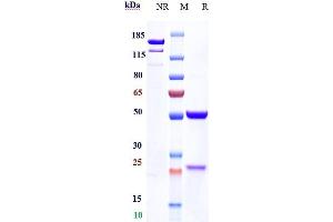 Anti-DKK1 Reference Antibody (BHQ-880) on SDS-PAGE under reducing (R) condition.