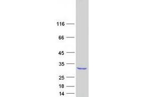Western Blotting (WB) image for Glutathione S-Transferase mu 4 (GSTM4) (Transcript Variant 1) protein (Myc-DYKDDDDK Tag) (ABIN2722277)