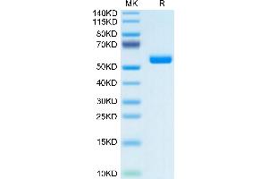 Human FAM3D on Tris-Bis PAGE under reduced condition. (FAM3D Protein (AA 26-224) (Fc Tag))