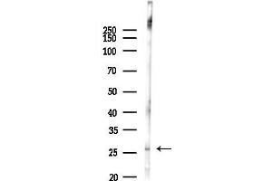 anti-Glutathione S-Transferase mu 5 (GSTM5) (N-Term) antibody