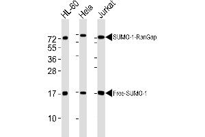 All lanes : Anti-SUMO1 Antibody at 1:4000 dilution Lane 1: HL-60 whole cell lysates Lane 2: Hela whole cell lysates Lane 3: Jurkat whole cell lysates Lysates/proteins at 20 μg per lane. (SUMO1 抗体)