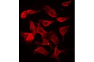 ABIN6275998 staining LOVO by IF/ICC. (GHRHR 抗体  (C-Term))