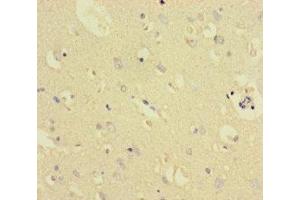 Immunohistochemistry of paraffin-embedded human brain tissue using ABIN7172006 at dilution of 1:100 (TXNDC8 抗体  (AA 1-115))