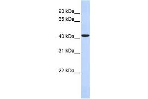 WB Suggested Anti-HAVCR1 Antibody Titration: 0. (HAVCR1 抗体  (N-Term))