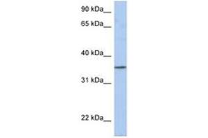 Image no. 1 for anti-Proline Rich 18 (PRR18) (AA 35-84) antibody (ABIN6743875) (Proline Rich 18 抗体  (AA 35-84))