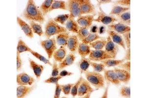 ICC testing of HeLa cells (HSD17B1 抗体  (AA 29-43))