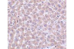 Immunohistochemistry of TIP47 in rat liver tissue with this product at 2 μg/ml. (PLIN3 抗体  (N-Term))