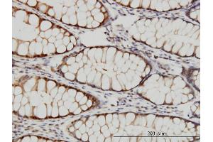 Immunostaining (ISt) image for anti-Proteasome (Prosome, Macropain) 26S Subunit, ATPase, 4 (PSMC4) (AA 1-418) antibody (ABIN562488)