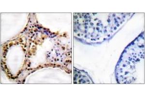 Immunohistochemistry analysis of paraffin-embedded human testis, using RAD52 (Phospho-Tyr104) Antibody. (RAD52 抗体  (pTyr104))