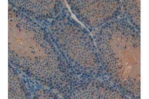 Immunohistochemistry (IHC) image for anti-Myosin IA (MYO1A) (AA 783-1043) antibody (ABIN7429532)