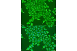 Immunofluorescence analysis of U2OS cells using BST2 antibody (ABIN1871361) at dilution of 1:100. (BST2 抗体)