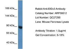 Western Blotting (WB) image for anti-Eukaryotic Translation Initiation Factor 2C3 (EIF2C3) (N-Term) antibody (ABIN2787837) (EIF2C3 抗体  (N-Term))