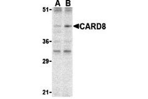 Western Blotting (WB) image for anti-Caspase Recruitment Domain Family, Member 8 (CARD8) (C-Term) antibody (ABIN1030312) (CARD8 抗体  (C-Term))