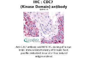 Image no. 1 for anti-Cell Division Cycle 7 (CDC7) antibody (ABIN1732914) (CDC7 抗体)