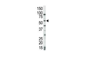 The anti-COT Pab (ABIN392472 and ABIN2842056) is used in Western blot to detect COT in HeLa cell lysate. (MAP3K8 抗体  (C-Term))