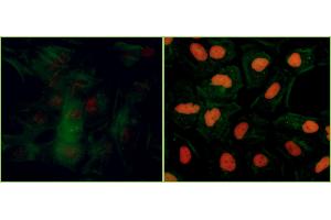 Immunofluorescence (IF) image for anti-Tripartite Motif Containing 28 (TRIM28) (pSer824) antibody (ABIN7454038) (Recombinant KAP1 抗体  (pSer824))