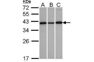 WB Image Sample(30 ug whole cell lysate) A:H1299 B:HeLa S3 C:MOLT4 , 12% SDS PAGE antibody diluted at 1:1000 (VTA1 抗体  (Center))