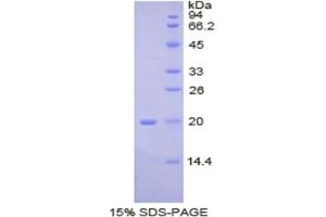 SDS-PAGE analysis of Pig BMP2 Protein. (BMP2 蛋白)