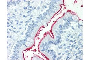Anti-NPC1L1 antibody IHC staining of human small intestine. (NPC1L1 抗体  (Internal Region))