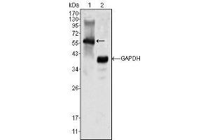 Western Blot showing MATK antibody used against K562 cell lysate (1). (MATK 抗体)