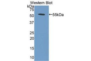 Western Blotting (WB) image for anti-Bone Morphogenetic Protein 5 (BMP5) (AA 317-454) antibody (ABIN3205479) (BMP5 抗体  (AA 317-454))