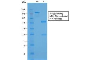 SDS-PAGE analysis of purified, BSA-free recombinant NKX2. (NKX2-1 抗体)
