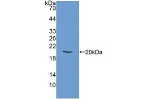 Detection of Recombinant EIF2aK3, Mouse using Polyclonal Antibody to Eukaryotic Translation Initiation Factor 2 Alpha Kinase 3 (EIF2aK3) (PERK 抗体  (AA 973-1114))