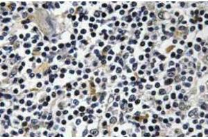 Immunohistochemistry (IHC) analyzes of p-Op18 antibody in paraffin-embedded human thymus gland tissue. (Stathmin 1 抗体  (pSer16))
