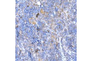 Immunohistochemistry of paraffin-embedded mouse spleen using M Rabbit pAb (ABIN3021414, ABIN3021415, ABIN3021416 and ABIN6215021) at dilution of 1:500 (40x lens). (MAGED1 抗体  (AA 635-834))