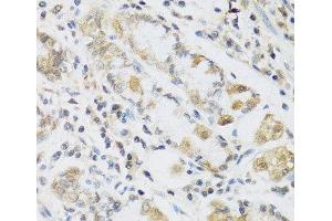 Immunohistochemistry of paraffin-embedded Human stomach using RETN Polyclonal Antibody at dilution of 1:100 (40x lens). (Resistin 抗体)