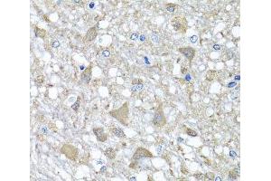 Immunohistochemistry of paraffin-embedded Rat brain using VPS37A Polyclonal Antibody at dilution of 1:100 (40x lens). (VPS37A 抗体)