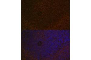 Immunofluorescence analysis of rat spleen using C Rabbit mAb (ABIN7266125) at dilution of 1:100 (40x lens). (CARD11 抗体)