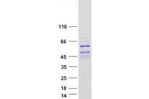 Validation with Western Blot