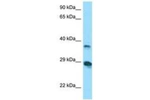 Image no. 1 for anti-V-Set and Immunoglobulin Domain-Containing Protein 4 (VSIG4) (AA 40-89) antibody (ABIN6748427) (VSIG4 抗体  (AA 40-89))