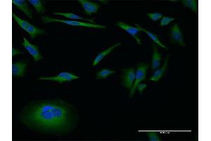 Immunofluorescence of monoclonal antibody to MMP26 on HeLa cell. (MMP26 抗体  (AA 152-261))