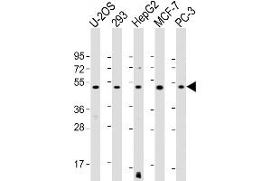 All lanes : Anti-EEF1A1P5 Antibody (C-Term) at 1:1000-1:2000 dilution Lane 1: U-2OS whole cell lysate Lane 2: 293 whole cell lysate Lane 3: HepG2 whole cell lysate Lane 4: MCF-7 whole cell lysate Lane 5: PC-3 whole cell lysate Lysates/proteins at 20 μg per lane. (EEF1A1P5 抗体  (AA 430-462))