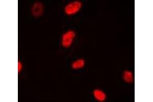 Immunofluorescent analysis of NSUN6 staining in MCF7 cells.