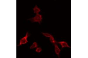 ABIN6266750 staining HeLa by IF/ICC. (NXF1 抗体  (N-Term))